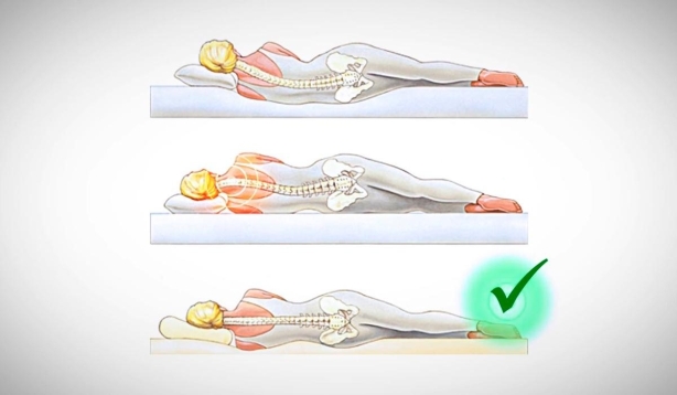 Сравнение положения позвоночника во время сна на обычных и ортопедической подушках